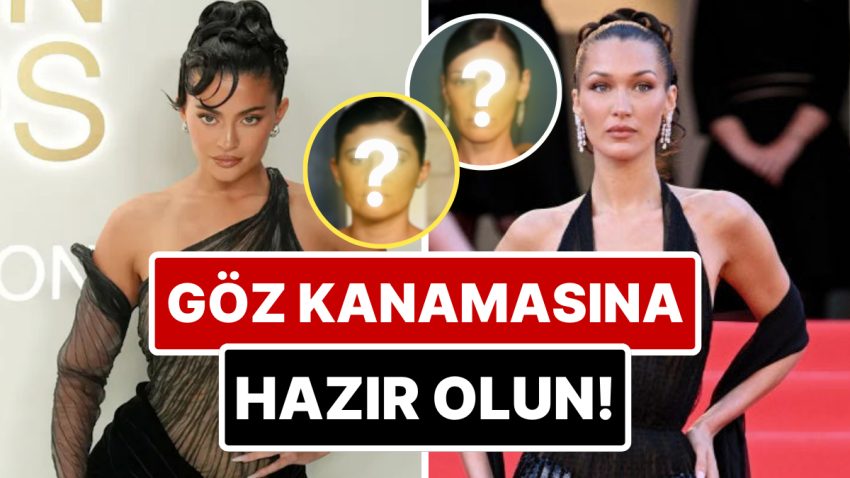 Göz Kanamasına Hazır Olun: Kylie Jenner’dan Hailey Bieber’a Hollywood Ünlüleri Estetiksiz Nasıl Gözükürdü?