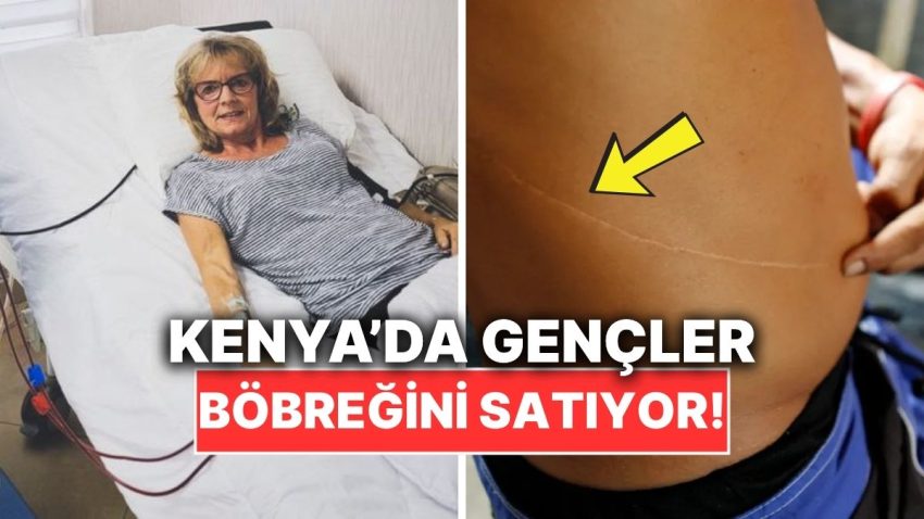 İnanması Sıkıntı Fakat Gerçek: Kenya’da Fakir Gençlerden Böbrek Satın Alınıyor