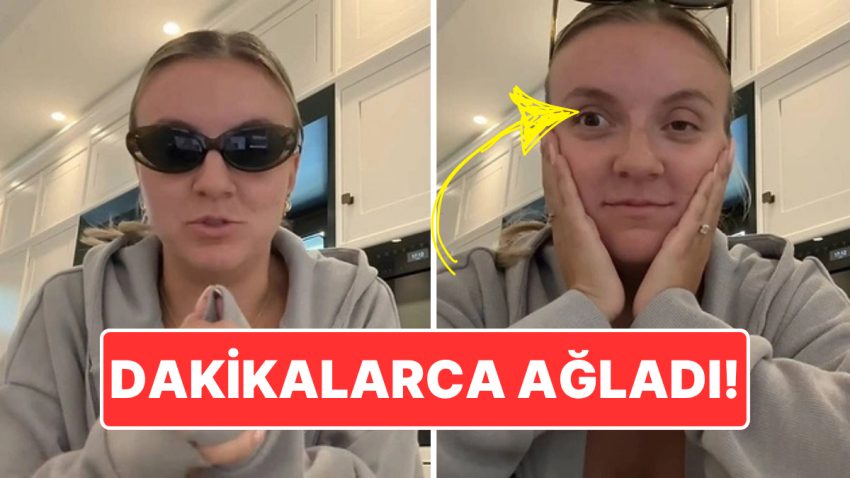 İkinci Kere Botoks Yaptıran İçerik Üreticisi Hayatının Pişmanlığını Yaşadı: Göz Kapaklarını Denetim Edemiyor