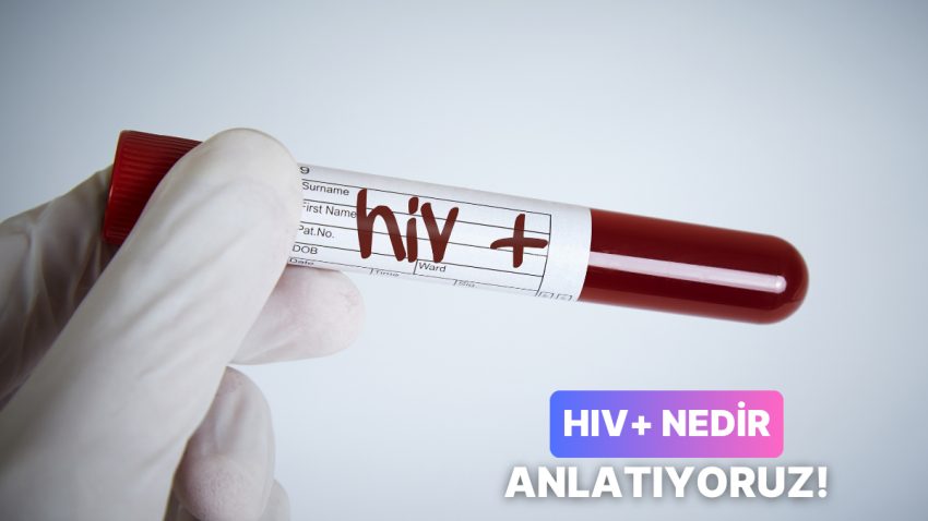 Sandığın Kadar Müthiş Bir Şey Olmadığını Söyleyelim! HIV+ Nedir?