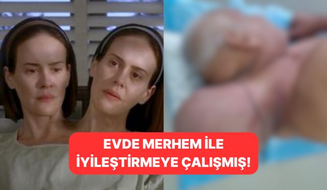 16-yil-boyunca-hastaneye-gitmeyen-adamin-ikinci-kafa-buyuklugundeki-tumoru-alindi-7jLQSeTT.jpg
