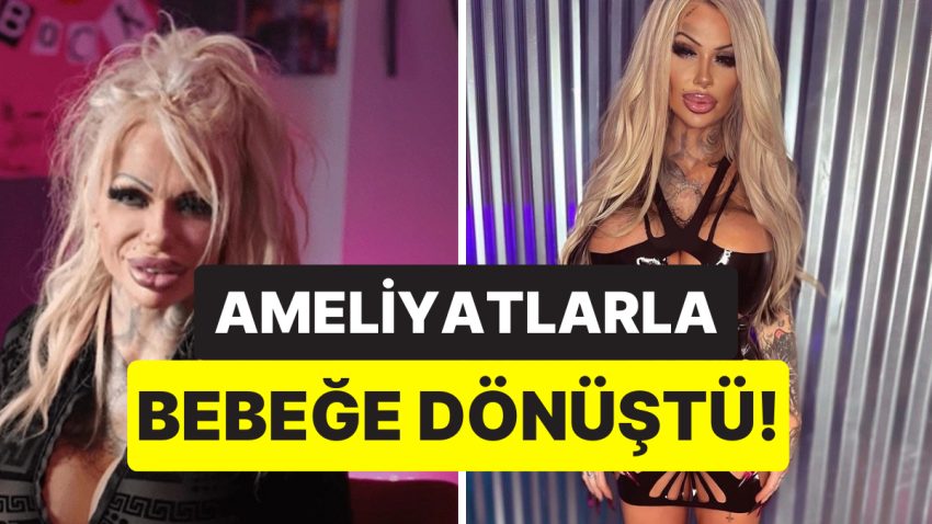 Ameliyatlarını Türkiye’de Yaptırıyor: Oyuncak Bebeğe Benzemek İçin 6 Milyon TL Harcayan Estetik Hastası Bayan