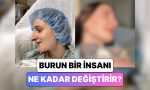 bir-bayan-gecirdigi-burun-estetigi-operasyonundan-sonra-yasadigi-degisimi-paylasti-aZc6mE8X.jpg