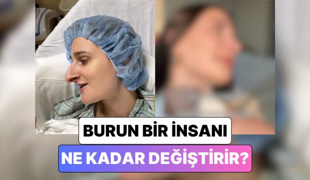 bir-bayan-gecirdigi-burun-estetigi-operasyonundan-sonra-yasadigi-degisimi-paylasti-aZc6mE8X.jpg