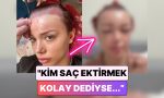 biz-sac-ekimi-ulkesiyiz-sac-ektirme-sureci-yaptiran-bir-bayan-yuzunun-geldigi-hali-paylasti-7tr3L3dp.jpg