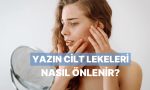 ciltteki-leke-gorunumune-karsi-yaz-aylarinda-alabileceginiz-tedbirler-41qXNjJy.jpg