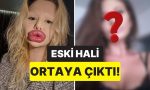 dunyanin-en-buyuk-dudakli-kadini-olarak-biliniyordu-estetik-gecirmeden-evvelki-hali-sasirtti-xIhgTh9d.jpg