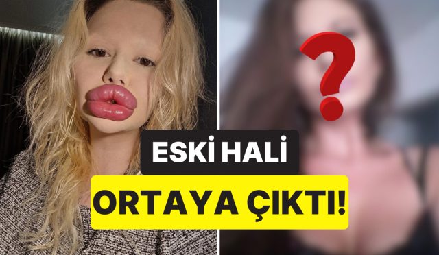dunyanin-en-buyuk-dudakli-kadini-olarak-biliniyordu-estetik-gecirmeden-evvelki-hali-sasirtti-xIhgTh9d.jpg