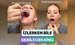 izlerken-gerileceksiniz-bir-bayan-dis-telini-ayarlamaya-calisirken-cenesi-kilitlendi-bvE8Uc9P.jpg