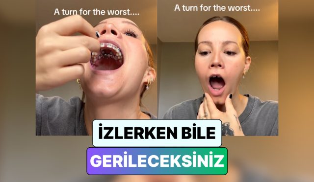 izlerken-gerileceksiniz-bir-bayan-dis-telini-ayarlamaya-calisirken-cenesi-kilitlendi-bvE8Uc9P.jpg