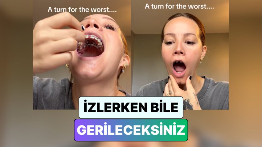 İzlerken Gerileceksiniz! Bir Bayan Diş Telini Ayarlamaya Çalışırken Çenesi Kilitlendi