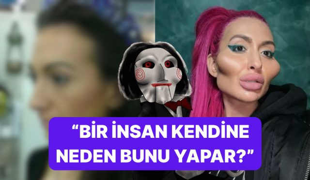 onlar-da-akilliya-hasret-dunyanin-en-buyuk-elmacik-kemiklerine-sahip-modelin-eski-hali-qHWxcUeM.jpg