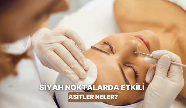 siyah-nokta-ve-gozeneklerde-tesirli-aha-ve-bha-asitleri-hakkinda-merak-edilenler-l3qnDSwt.jpg