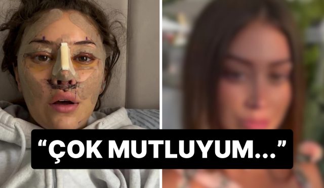28-yasinda-turkiyede-yuz-germe-yaptiran-turistin-son-hali-gundem-oldu-en-uygun-versiyonum-MlyqV1DB.jpg