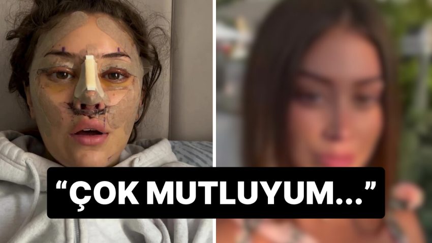 28 Yaşında Türkiye’de Yüz Germe Yaptıran Turistin Son Hali Gündem Oldu: “En Uygun Versiyonum Oldum”