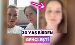 30-yas-genclesti-tipki-anda-birkac-estetik-operasyon-geciren-bayan-inanilmaz-degisimiyle-sasirtti-mHnj8AuS.jpg