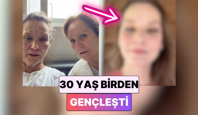 30-yas-genclesti-tipki-anda-birkac-estetik-operasyon-geciren-bayan-inanilmaz-degisimiyle-sasirtti-mHnj8AuS.jpg