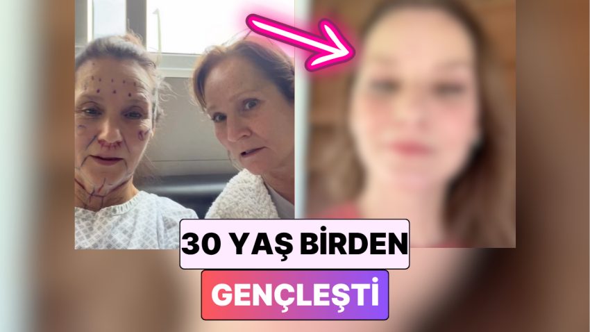 30 Yaş Gençleşti: Tıpkı Anda Birkaç Estetik Operasyon Geçiren Bayan İnanılmaz Değişimiyle Şaşırttı