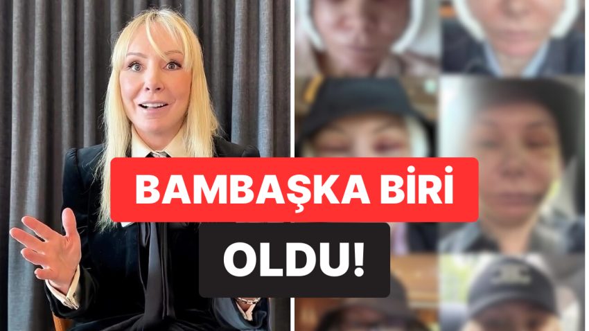 59 Yaşında ‘Jenner Estetiği’ İçin Kore’ye Gitti, Farklı Biri Oldu