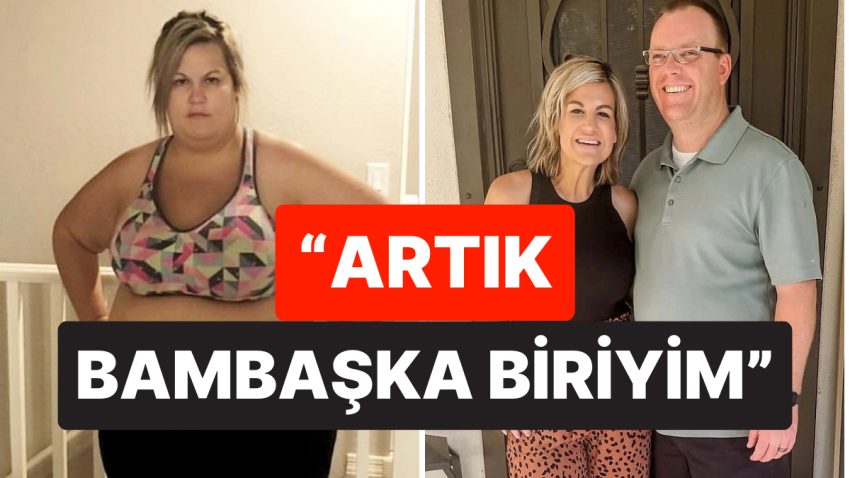 79 Kilo Verdi, Hayatı Değişti: Büyük Dönüşüm Sonrası Eşini Bile Kıskandıran Bayan O Süreci Anlattı