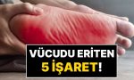 bedeniniz-paslaniyor-olabilir-kalp-ve-bobrekleri-yoran-sessiz-iltihabin-5-kritik-isareti-sx4gBh8j.jpg