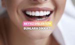 bembeyaz-dislere-giden-yolda-karsiniza-cikan-11-gercek-bilinen-yanlis-D8Atp5KO.jpg
