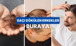 beyefendiler-sizi-unutmadik-erkek-tipi-sac-dokulmesine-karsi-tesirli-tahliller-gWrlpQFa.jpg
