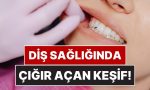 bilim-insanlari-acikladi-dis-curugune-karsi-en-guclu-savunma-agizda-saklaniyor-hItB1MEY.jpg