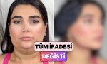 bir-bayanin-gidi-ve-yuz-germe-ameliyatindan-sonraki-degisimi-begeni-topladi-Fm2TA6DR.jpg