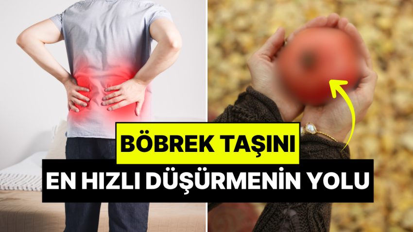 Böbrek Taşı En Süratli Nasıl Düşer? Uzmanlar Böbrek Taşını Eriten Bitkileri Açıkladı!