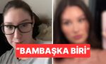 botoks-sonrasi-degisimini-paylasan-bayan-gundem-oldu-eJrjSjYO.jpg
