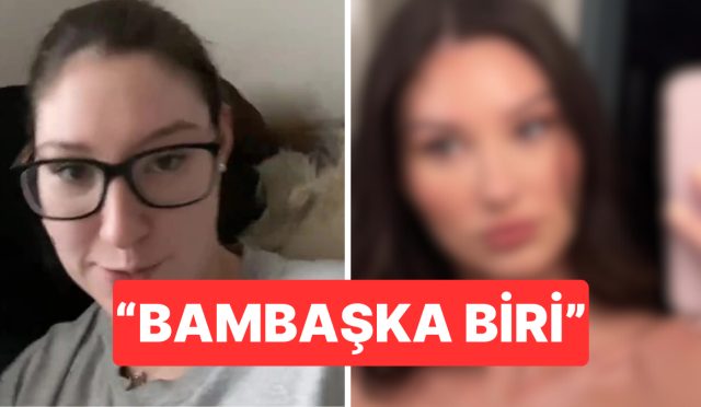 botoks-sonrasi-degisimini-paylasan-bayan-gundem-oldu-eJrjSjYO.jpg