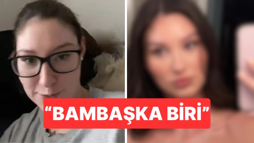 Botoks Sonrası Değişimini Paylaşan Bayan Gündem Oldu