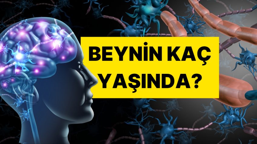 Bu 5 Sorudan En Az 3’üne “Evet” Diyorsanız Beyniniz Hayli Yaşlı