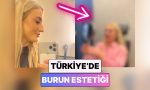burun-estetigi-icin-turkiyeye-gelen-bir-bayan-yasadigi-degisimi-ve-memnunlugunu-paylasti-Y4ESKhEu.jpg