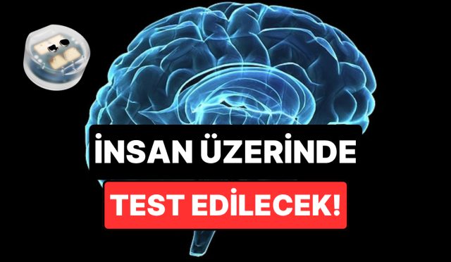 depresyon-geciren-beyin-implanti-insan-uzerinde-test-edilmeye-hazirlaniyor-x9brrjLm.jpg