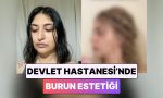 devlet-hastanesinde-burun-estetigi-yaptiran-bayan-gunler-icinde-yasadigi-degisimi-paylasti-rCf5S2CH.jpg