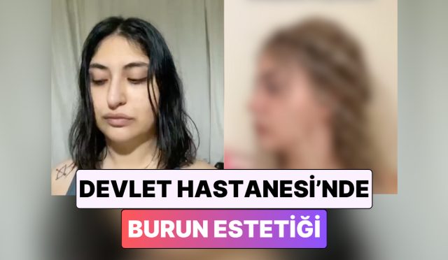 devlet-hastanesinde-burun-estetigi-yaptiran-bayan-gunler-icinde-yasadigi-degisimi-paylasti-rCf5S2CH.jpg