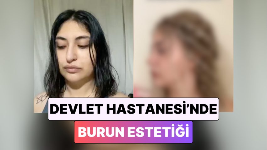 Devlet Hastanesinde Burun Estetiği Yaptıran Bayan Günler İçinde Yaşadığı Değişimi Paylaştı