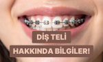 dis-teli-uzerine-bilmeniz-gereken-her-seyi-anlattik-DOjfLVEp.jpg