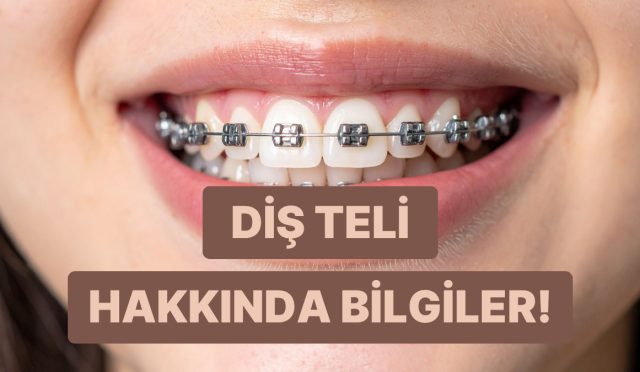 dis-teli-uzerine-bilmeniz-gereken-her-seyi-anlattik-DOjfLVEp.jpg