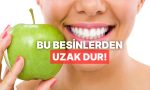 dislerinizin-curumesini-istemiyorsaniz-genel-olarak-uzak-durmaniz-gereken-besinler-ASZgZHZ2.jpg