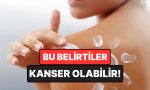 doktor-uyardi-normal-bir-kasinti-saniliyor-lakin-kanser-belirtisi-olabilir-sZtVrtmy.jpg