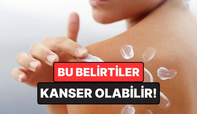 doktor-uyardi-normal-bir-kasinti-saniliyor-lakin-kanser-belirtisi-olabilir-sZtVrtmy.jpg