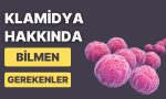 en-yaygin-cinsel-yolla-aktarilan-enfeksiyonlardan-biri-olan-klamidya-hakkinda-bilmeniz-gereken-9-sey-x6gay6yn.jpg