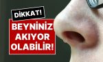 gecmeyen-burun-akintisinin-nedeni-nedir-beyin-siviniz-akiyor-olabilir-ujzQhqMf.jpg