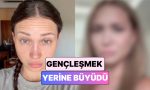gerekli-mi-erken-mi-botoks-yaptiran-25-yasindaki-bayan-yasadigi-degisimi-paylasti-mZGxypS3.jpg