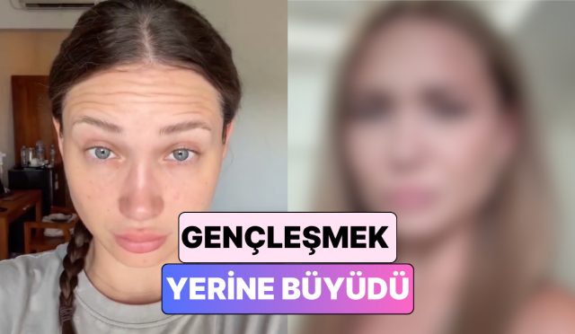 gerekli-mi-erken-mi-botoks-yaptiran-25-yasindaki-bayan-yasadigi-degisimi-paylasti-mZGxypS3.jpg