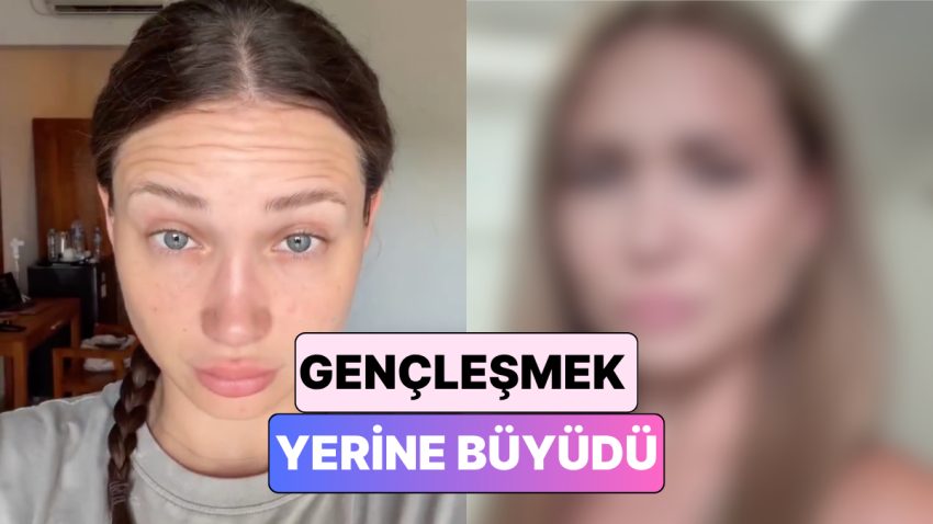 Gerekli mi Erken mi? Botoks Yaptıran 25 Yaşındaki Bayan Yaşadığı Değişimi Paylaştı