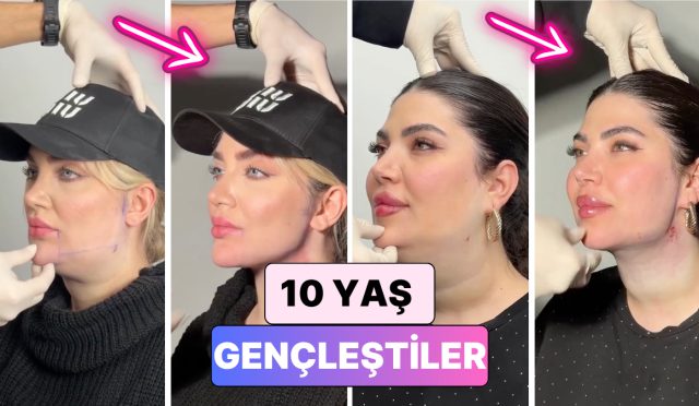 gidi-operasyonu-ile-bilinen-bir-doktor-hastalarinin-yasadigi-degisimi-paylasti-lLycDwtx.jpg